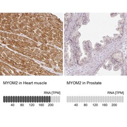 Myomesin 2 Antibody, Novus Biologicals 25 &mu;L; Unlabeled:Antibodies,